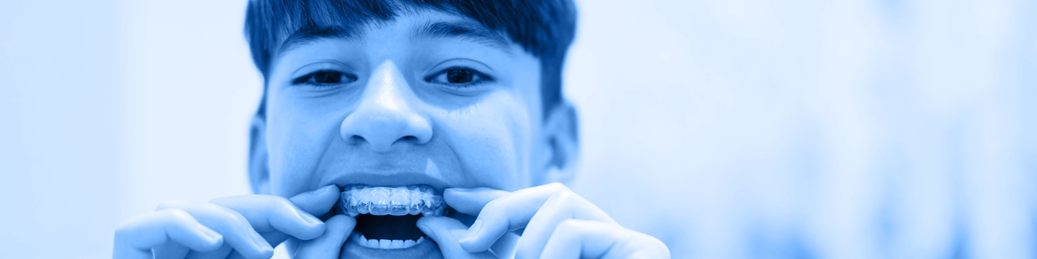 Invisalign for Teens Teen Invisalign El Paso, TX